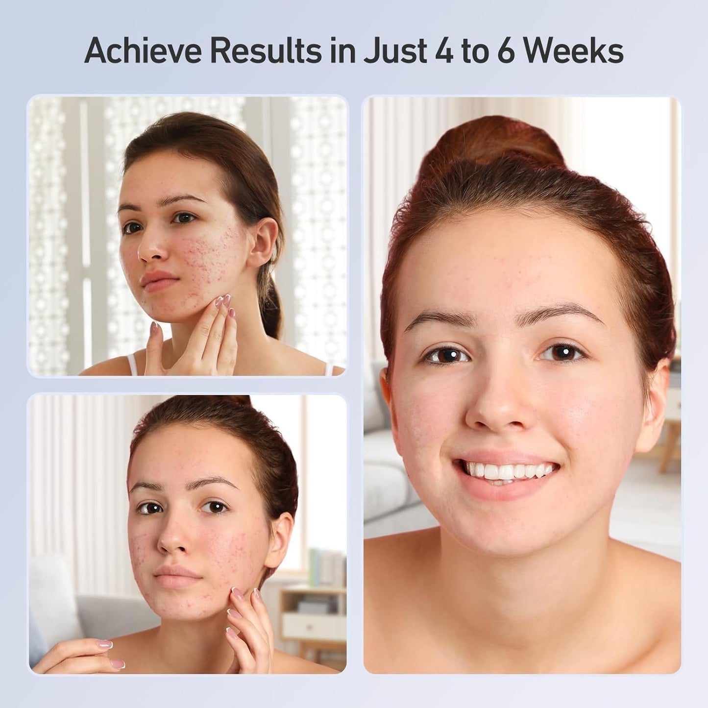 Lumured Red Light Therapy Face Mask