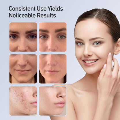 Lumured Red Light Therapy Face Mask